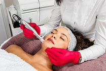 micro-needling prp
