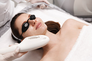 fotofacials