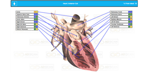 comprehensive heart scan