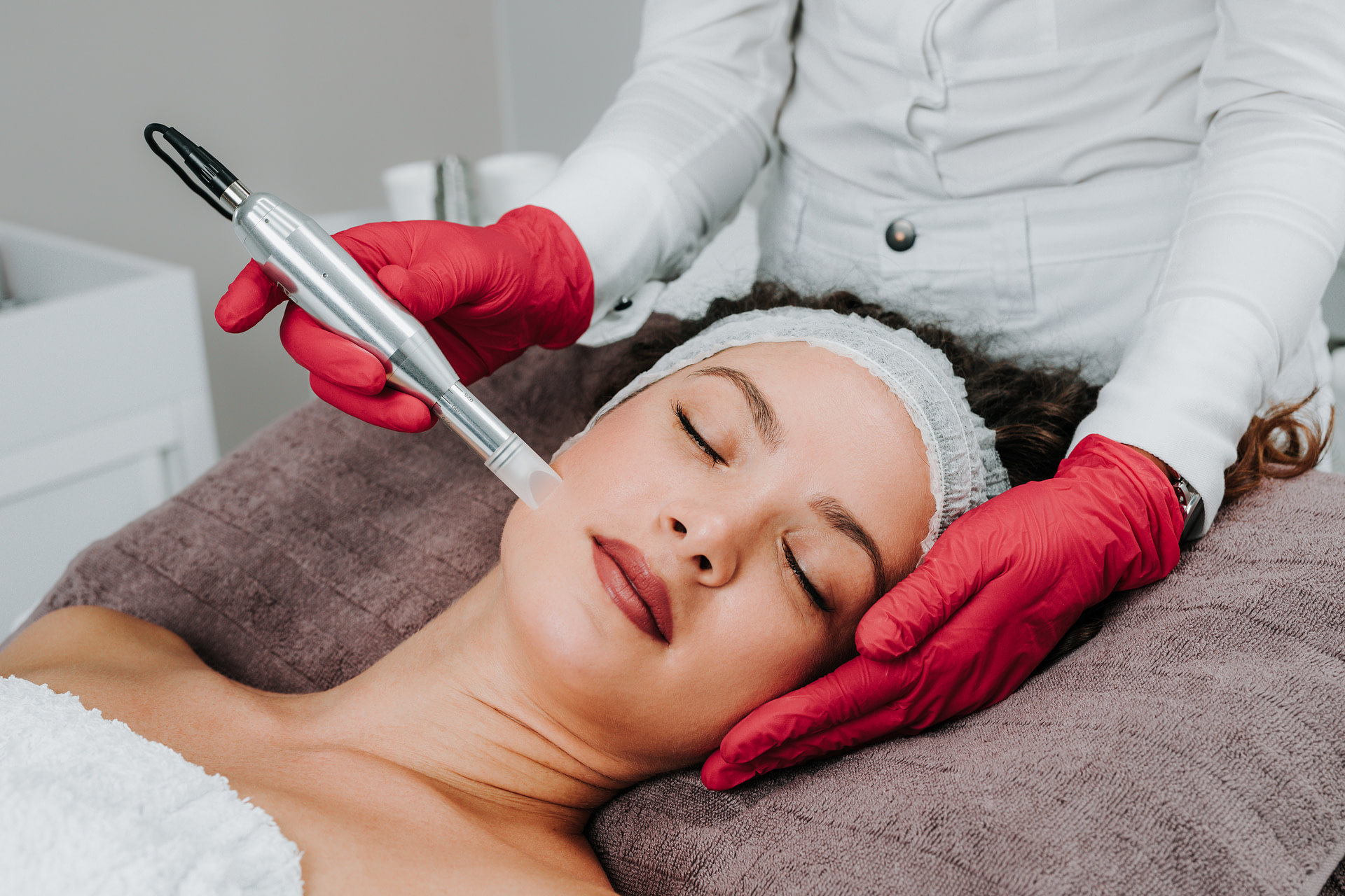 micro-needling